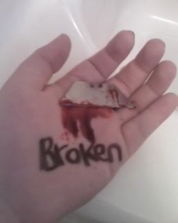 you broken thing 1..