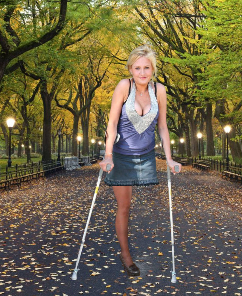 One leg in the park by Ippldatsch on DeviantArt