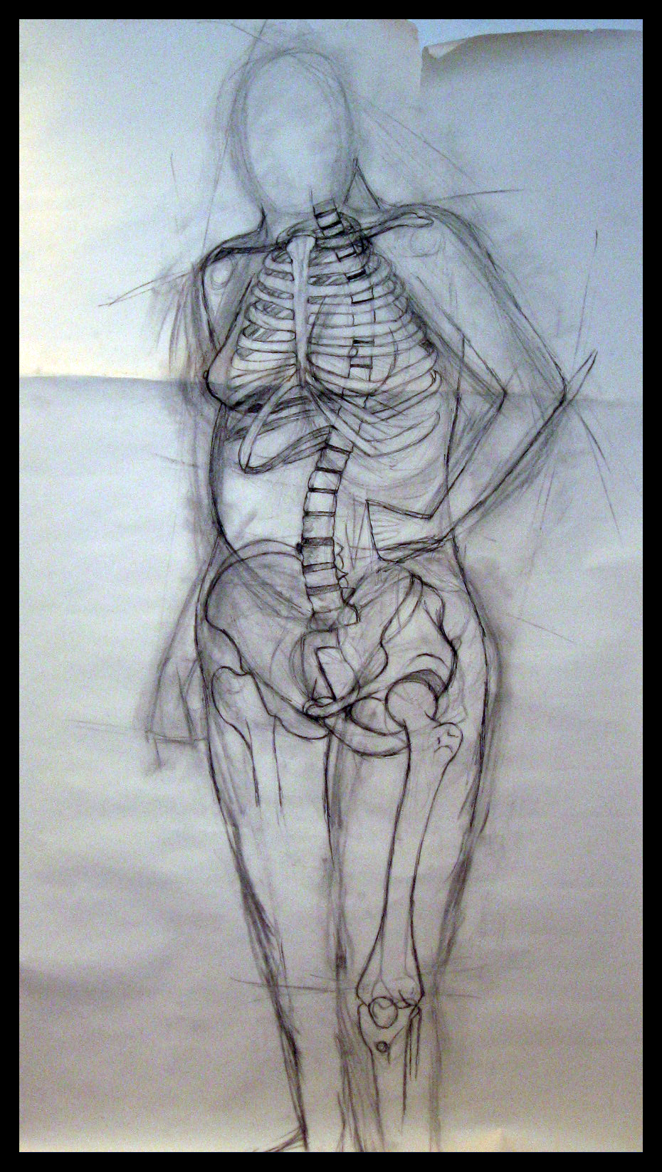 Bone Study