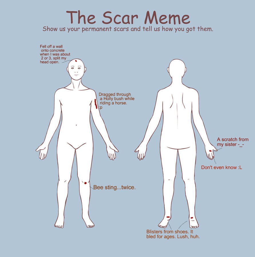 Scar meme