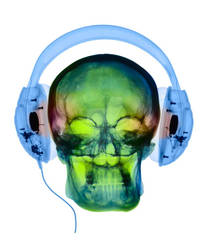 C0036175-Using headphones, Coloured X-ray