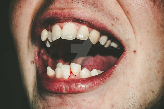 Ugly Teeth
