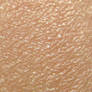 Skin texture