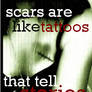 Scars