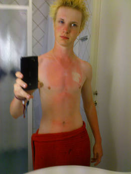 Sun burned Fairy Tail tattoo