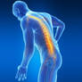 Spinal-Cord-Injuries