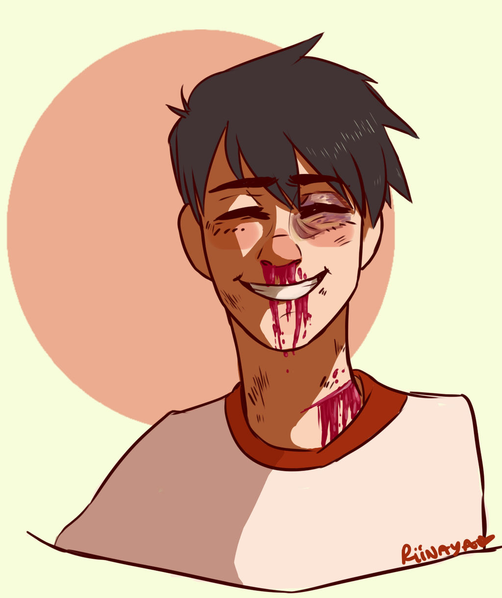 bloodied and bruised