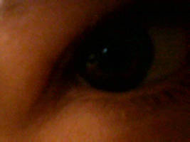 My Eye