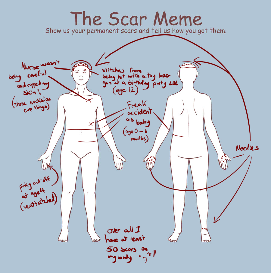 The Scar Meme- Phantom