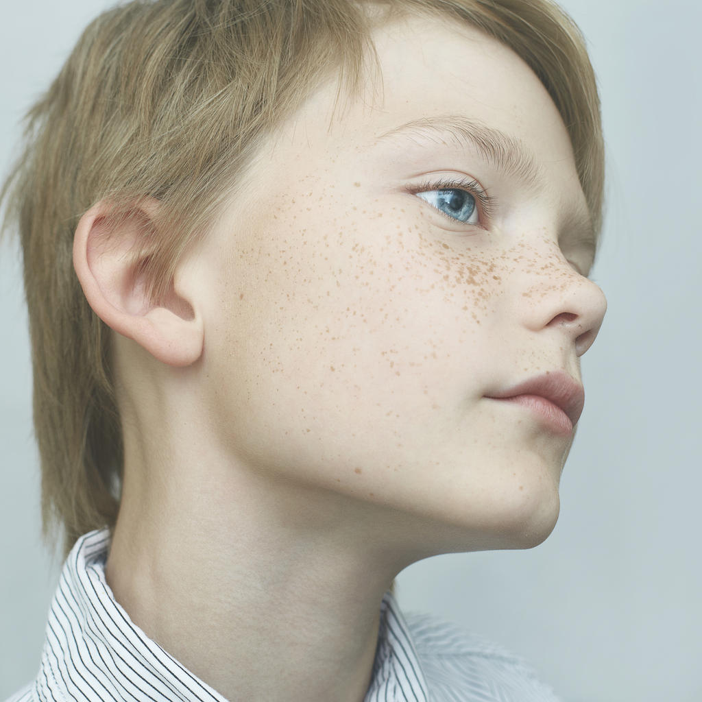 boy with freckles