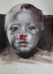 Bloody Nose - 01122011 by AEnigm4