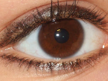 My eye