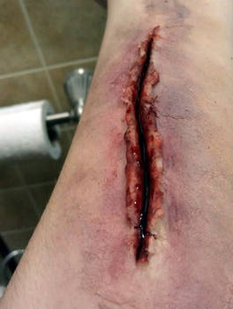 Sliced Arm (Close Up)