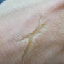 Fake Scar