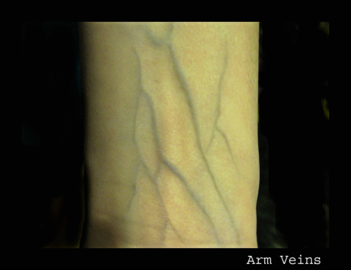 Arm veins III