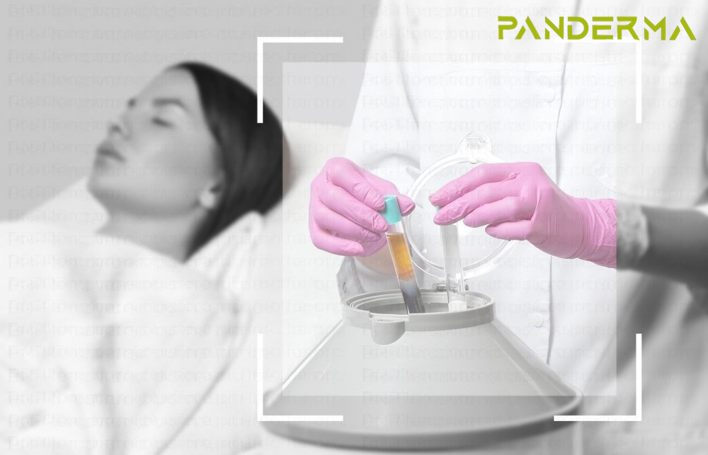 Prp Centrifuge 1