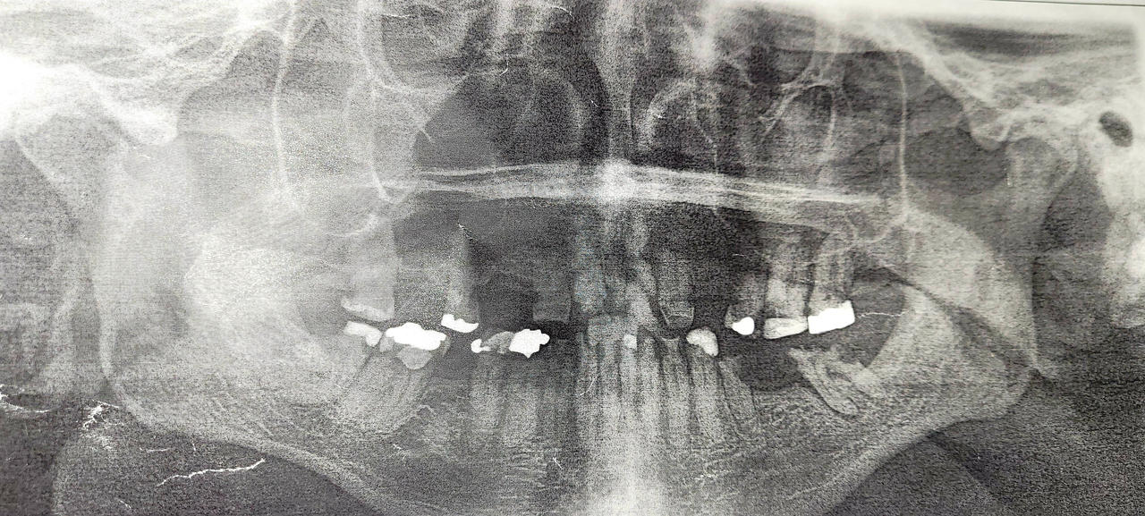 Good Riddance by flytier on DeviantArt