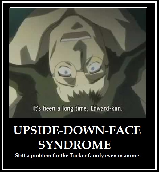 Upside down face syndrome