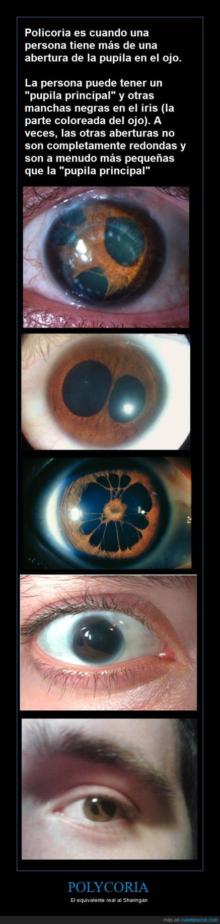 Polycoria by Axiloz on DeviantArt