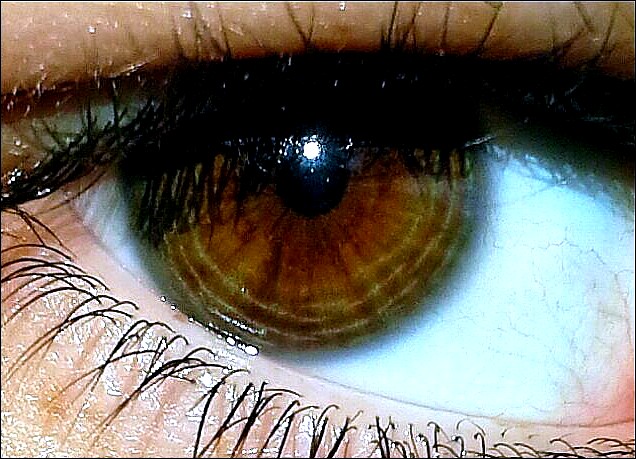 Eye Color.