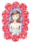 Ring A Ring O' Roses (Skeleton Girl) by PrettyAlice95