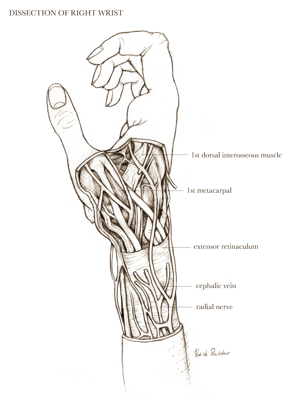 Wrist Anatomy by NovahNaigahfah on DeviantArt Biology Diagrams