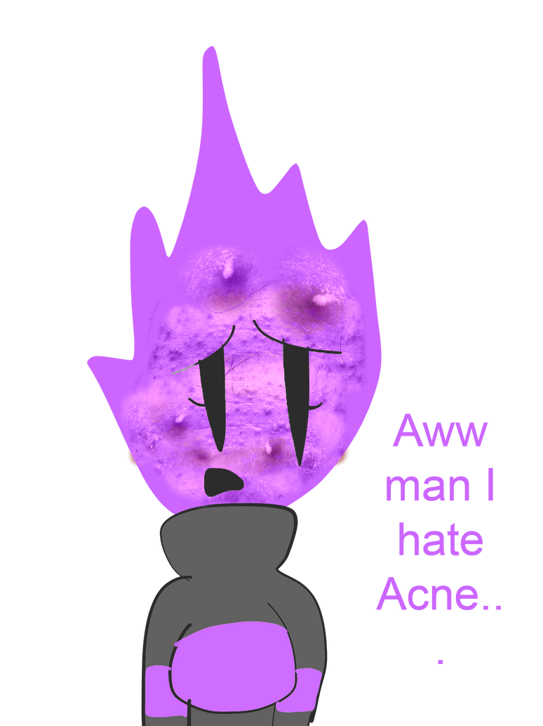 Acne Scratch Acne by UchiUrchin on DeviantArt