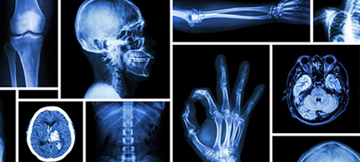 Radiology 1 Main Graphic 720 x 324