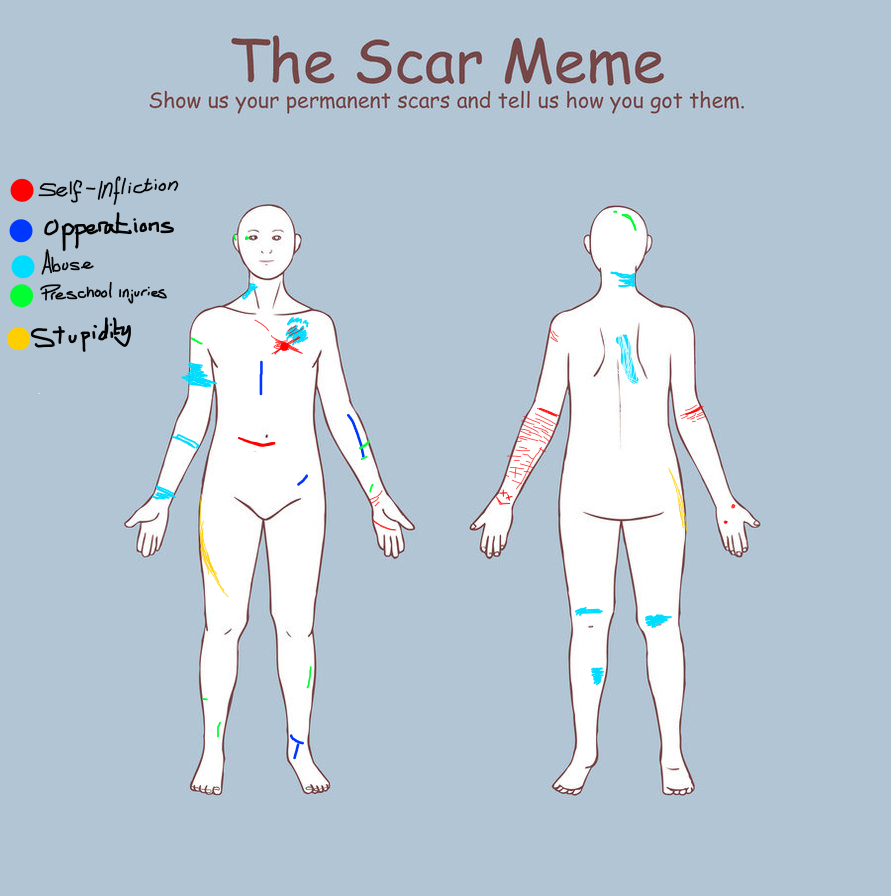 All Dem Scars -meme