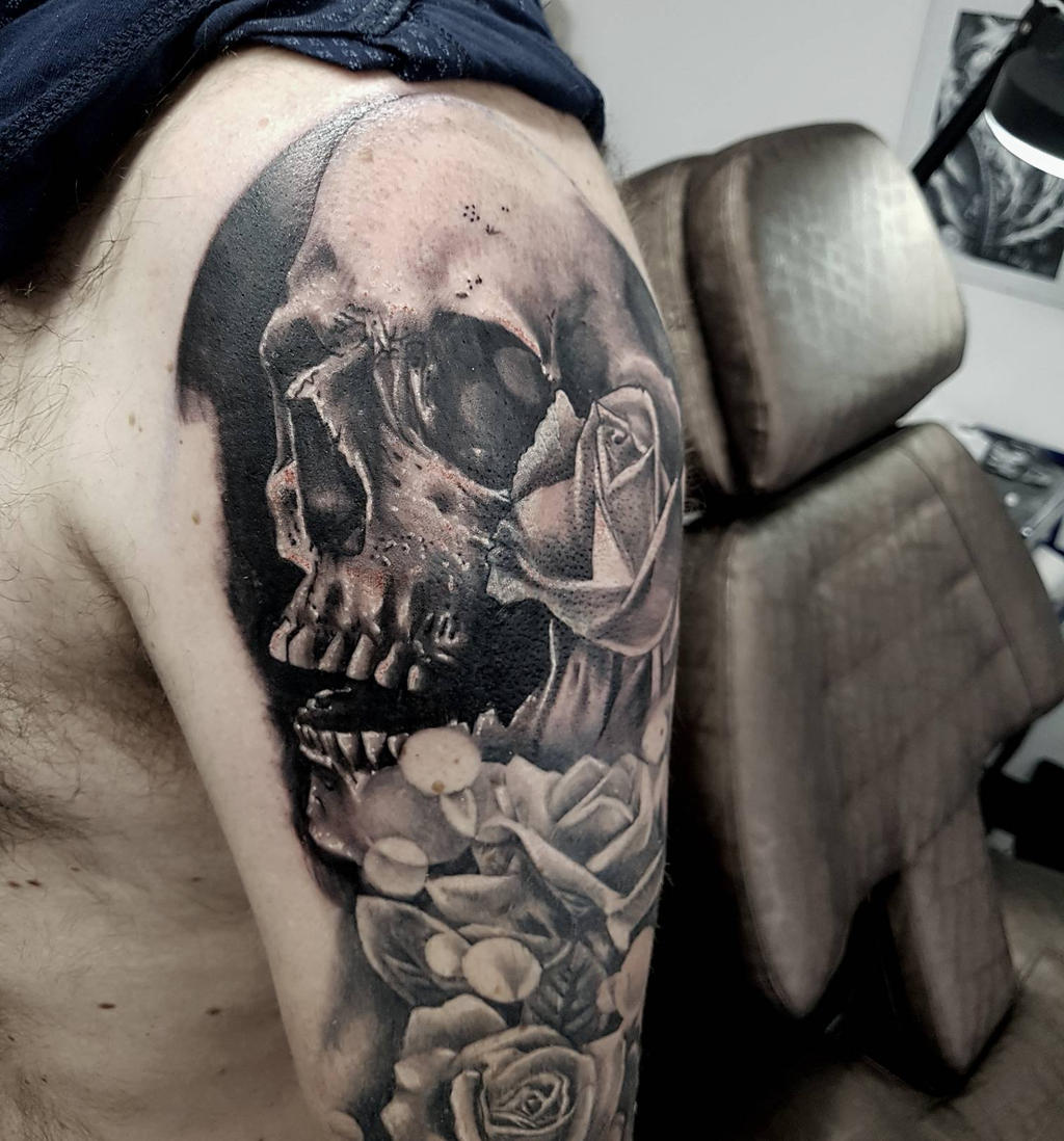 skull addition