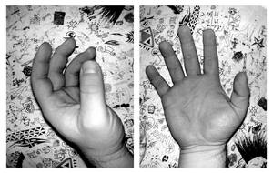 my hands