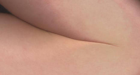 'Guess the body part' no.1