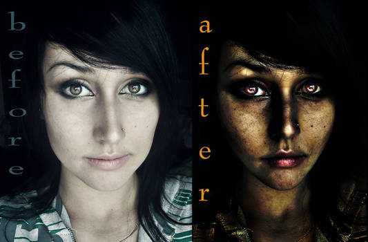 Before-After Scars