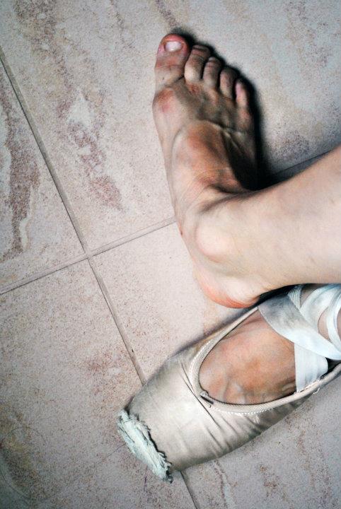 Ballet pain