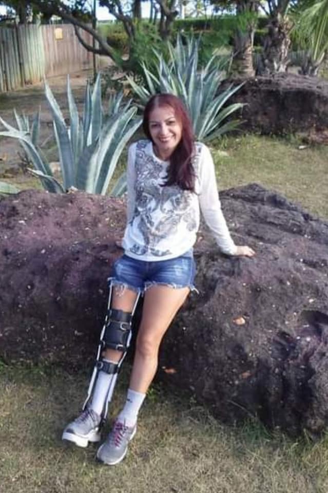 Leg Modification Deviantart Legbrace by SteveH51 on DeviantArt