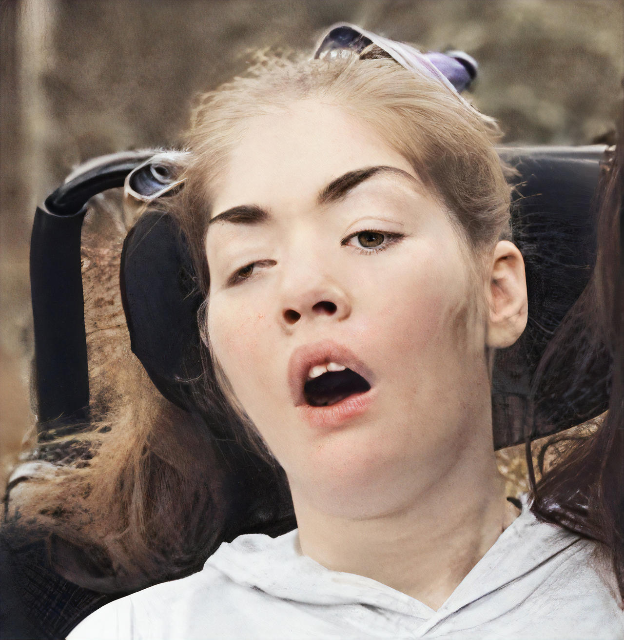Serene 'we Never Stopped Hoping And Praying' – Cork Woman Dies After 17 Years With Locked-in Syndrome Abstract Illustration Serene 'we Never Stopped Hoping And Praying' – Cork Woman Dies After 17 Years With Locked-in Syndrome Abstract Illustration