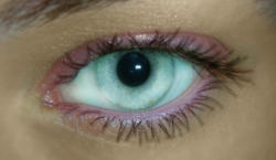 Mon Oeil