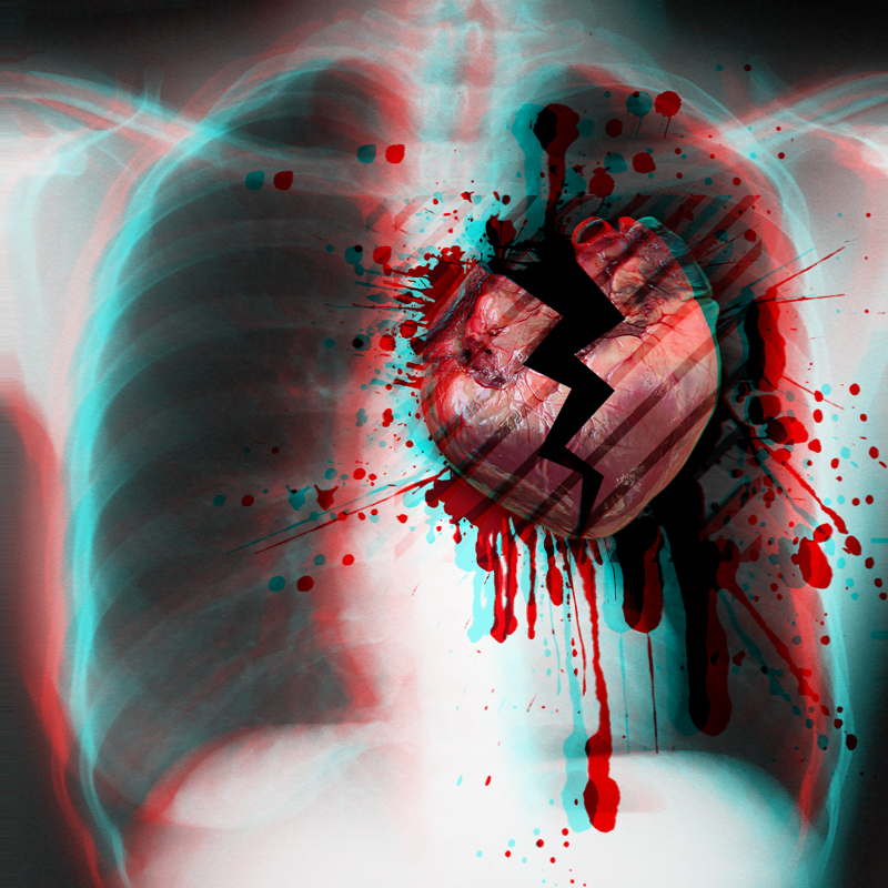 Broken Heart Anaglyph 3D by mildor666 on DeviantArt