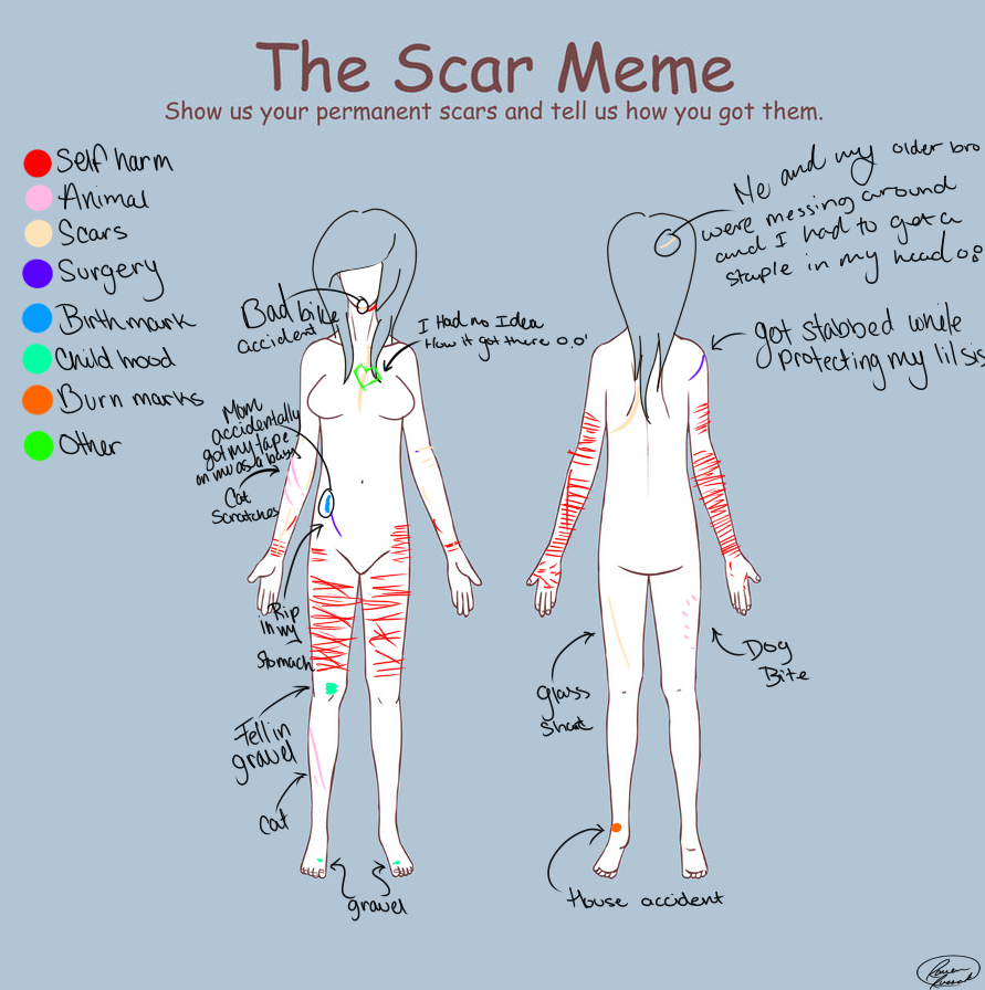 The Scar Meme