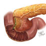 Inflamed Pancreas