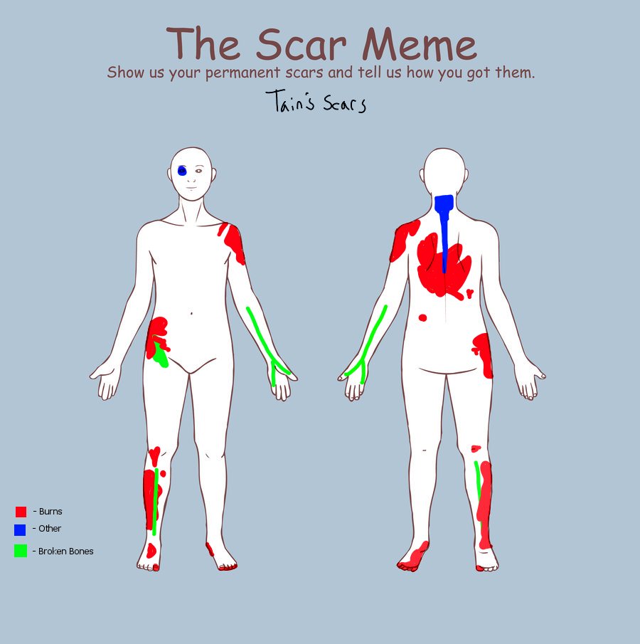 SCAR MEME!!! Tains scars