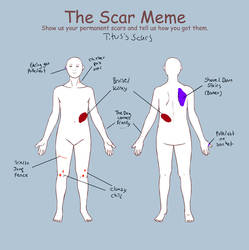 SCAR MEME!!! Tisus's Scars