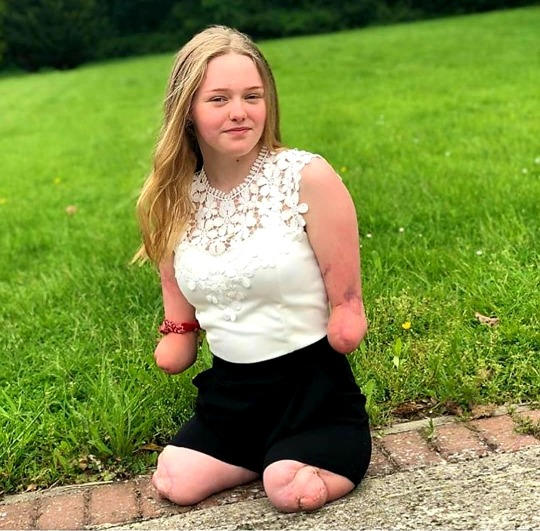 Amputee female pictures quad Stories Archive