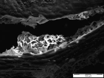 SEM - Oak leaf CLOSER