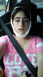 wisdom teeth have come out!