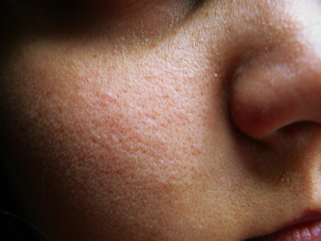 Face Close Up Skin Texture By FishsJourney On DeviantArt face-close-up-skin-texture-by-fishsjourney-on-deviantart