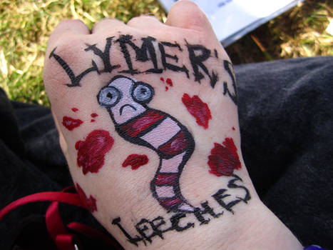 Lymer's
