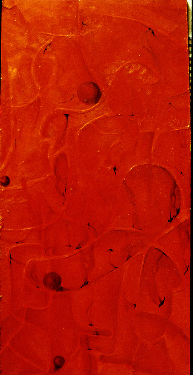 Cross-section of uterus by krtnik