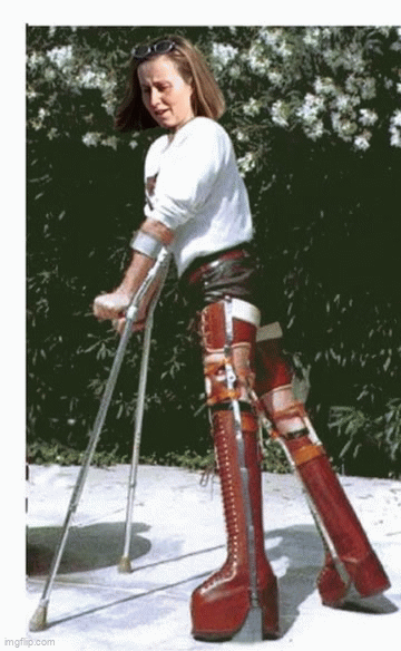 Leg Modification Deviantart heavy braces by AlwaysLegBraces on DeviantArt