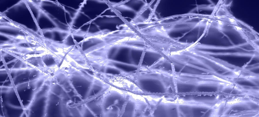 neuron fire by Blackpsychadelia on DeviantArt